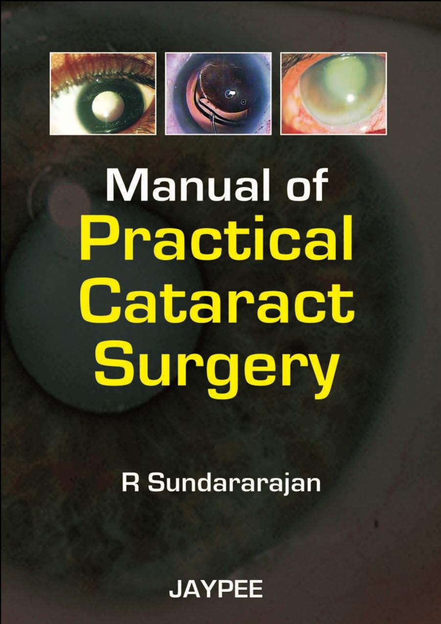 Manual of Practical Cataract Surgery by Sundarajan