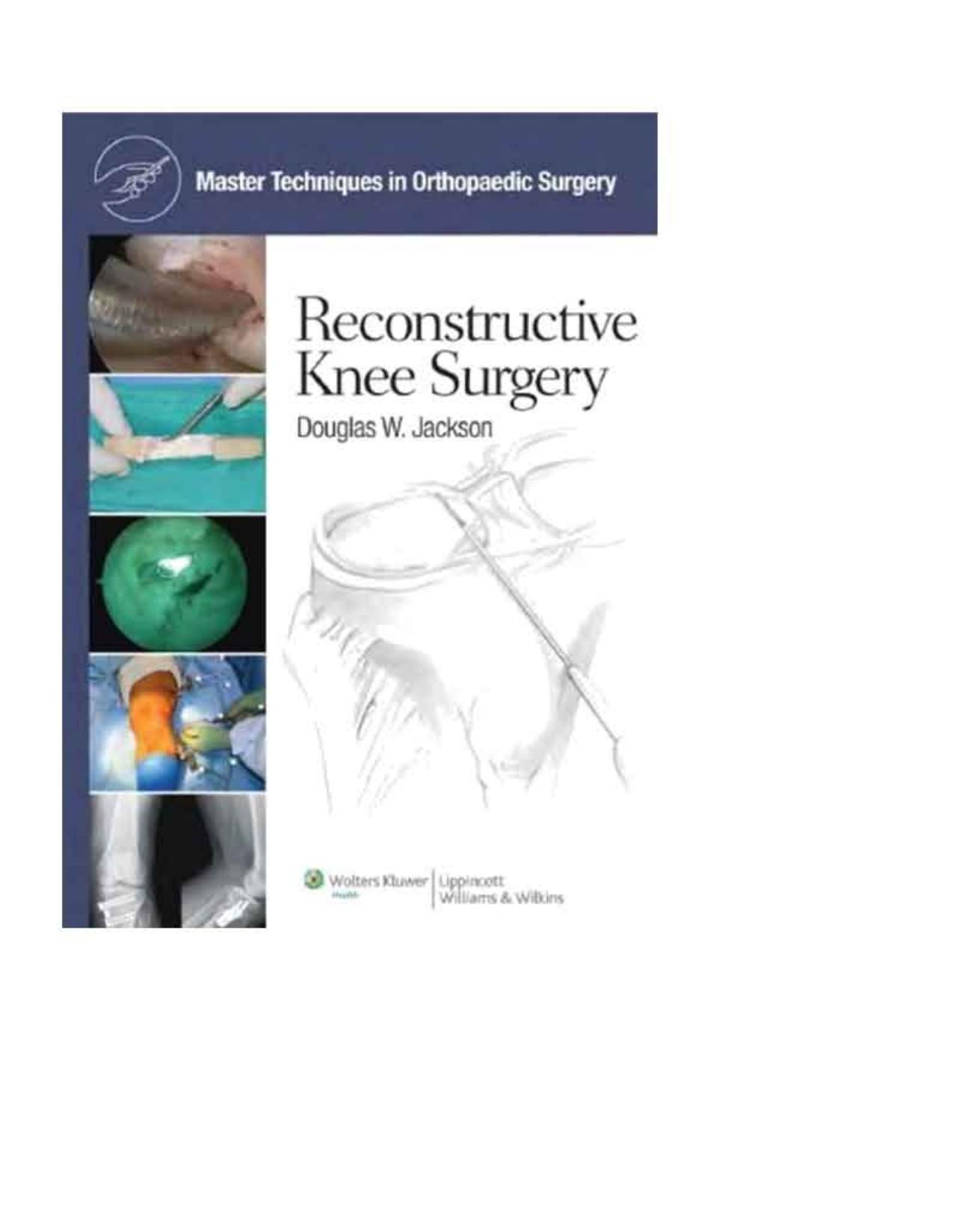 Master Techniques in Orthopaedic Surgery Reconstructive Knee Surgery by Douglas W. Jackson