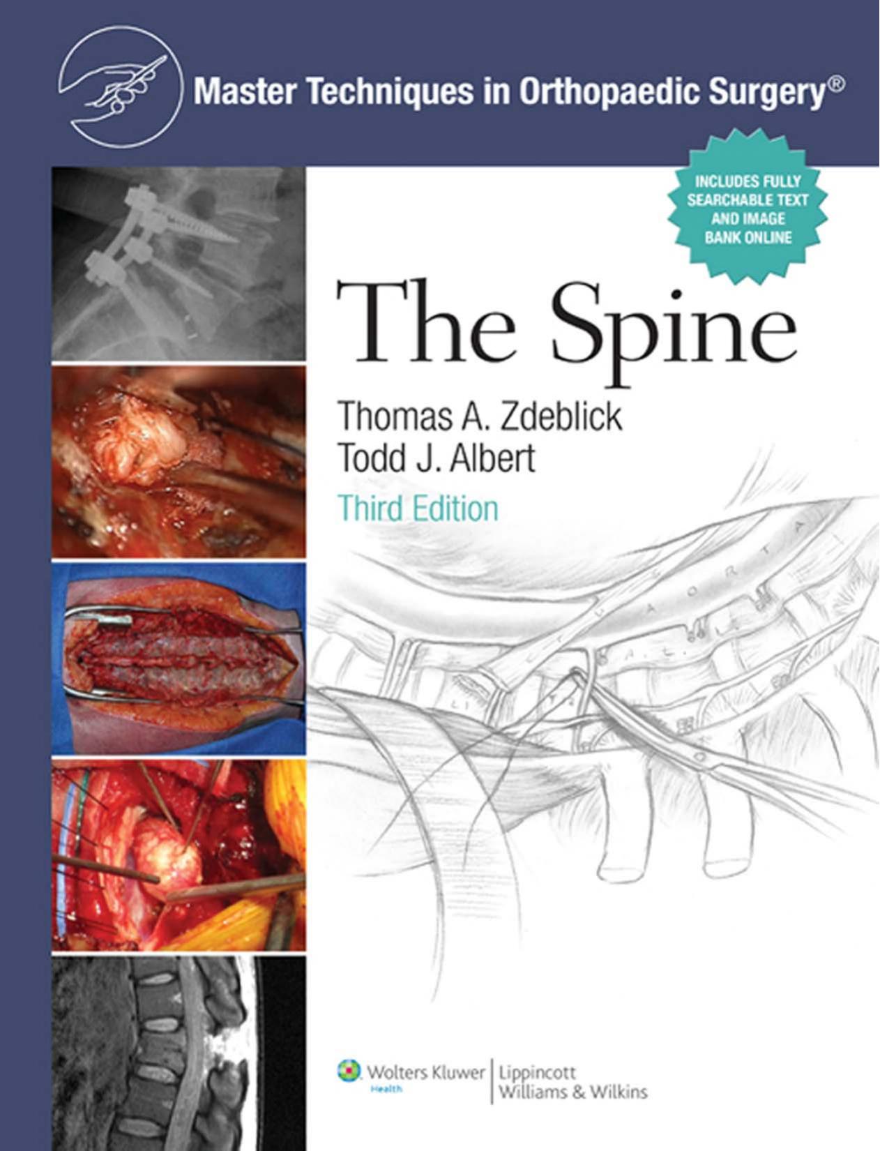 Master Techniques in Orthopaedic Surgery The Spine 3rd Edition by Thomas A. Zdeblick Todd J. Albert
