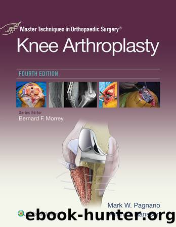 Master Techniques in Orthopaedic Surgery: Knee Arthroplasty, Fourth Edition by Mark W. Pagnano MD Arlen D. Hanssen MD