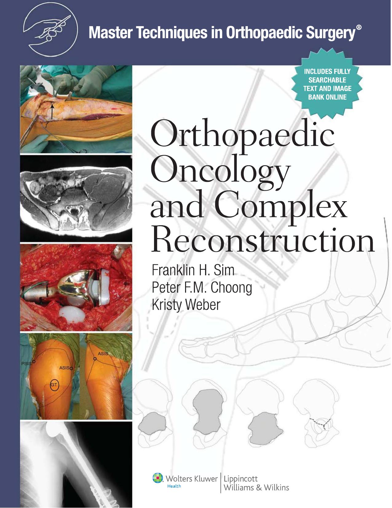 Master Techniques in Orthopaedic Surgery: Orthopaedic Oncology and Complex Reconstruction by Franklin H. Sim MD Peter F.M. Choong MD MBBS Kristy L. Weber MD