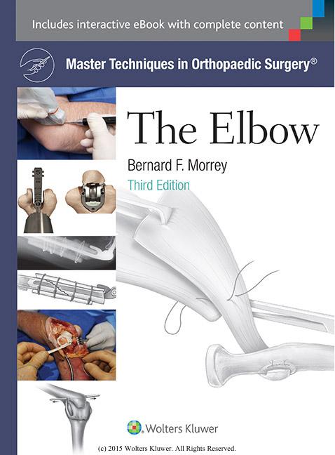Master Techniques in Orthopaedic Surgery: The Elbow by Bernard F. Morrey