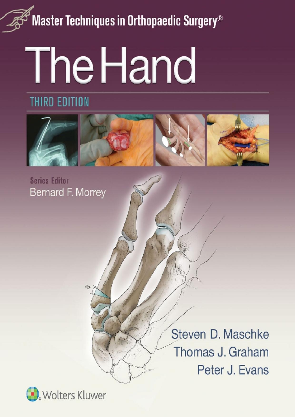 Master Techniques in Orthopaedic Surgery: The Hand 3rd Edition by Unknow