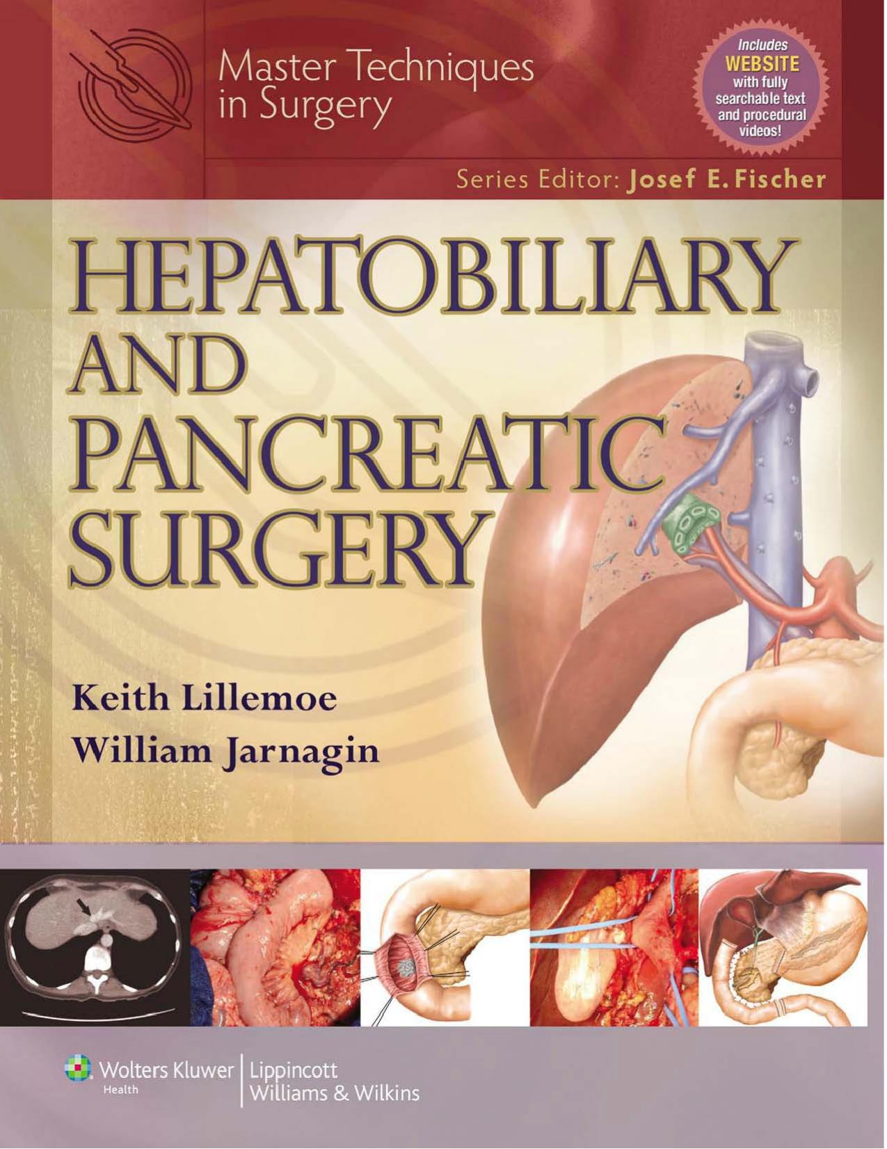 Master Techniques in Surgery: Hepatobiliary and Pancreatic Surgery by Unknow
