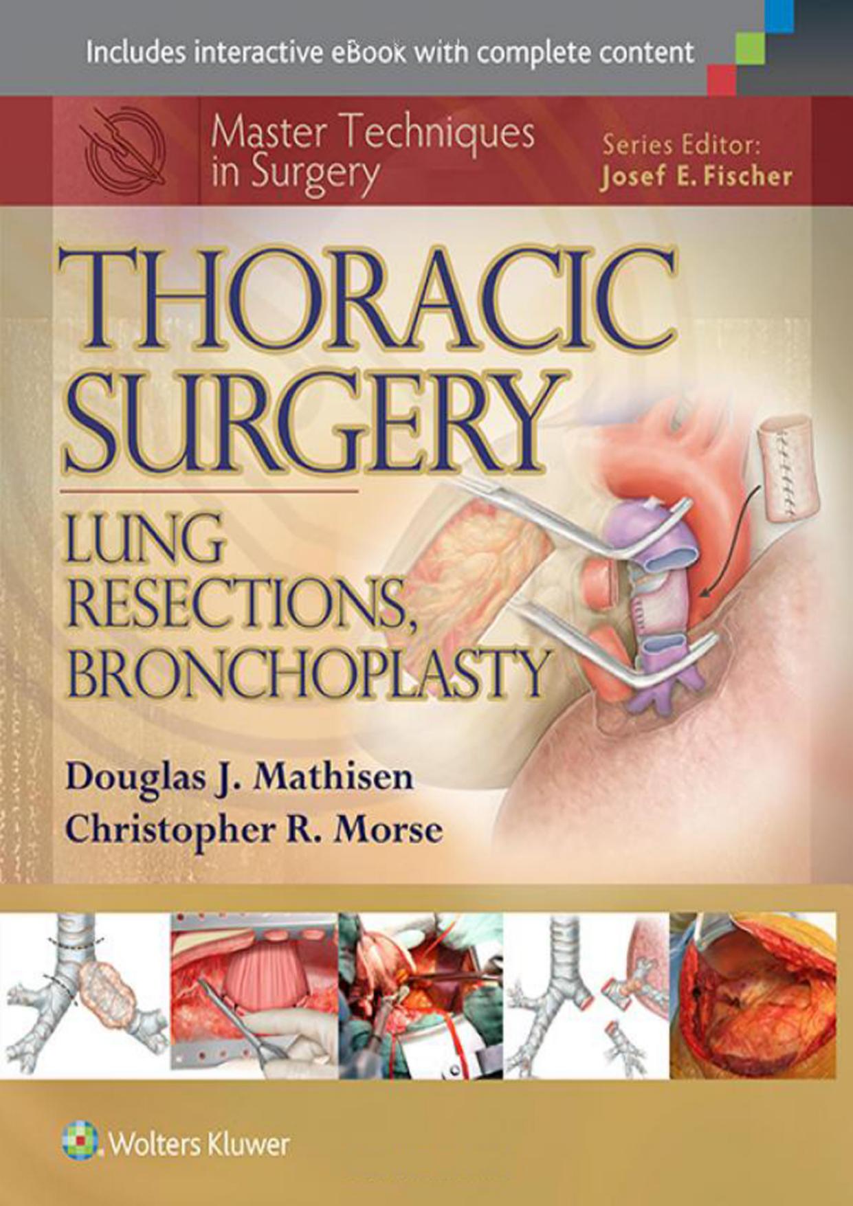 Master Techniques in Surgery: Thoracic Surgery: Lung Resections, Bronchoplasty by Douglas J. Mathisen MD Christopher Morse