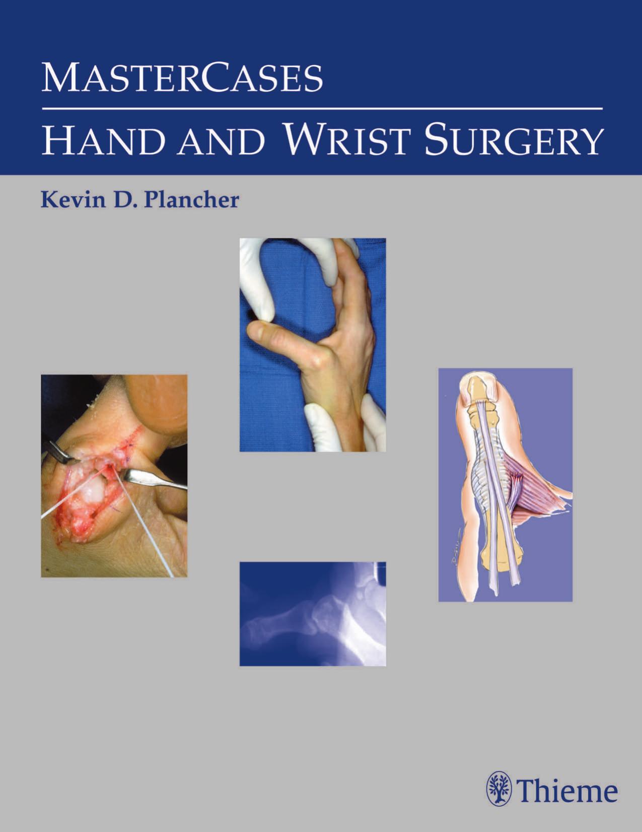 MasterCases. Hand and Wrist Surgery by Plancher Kevin D.; Luke Timothy