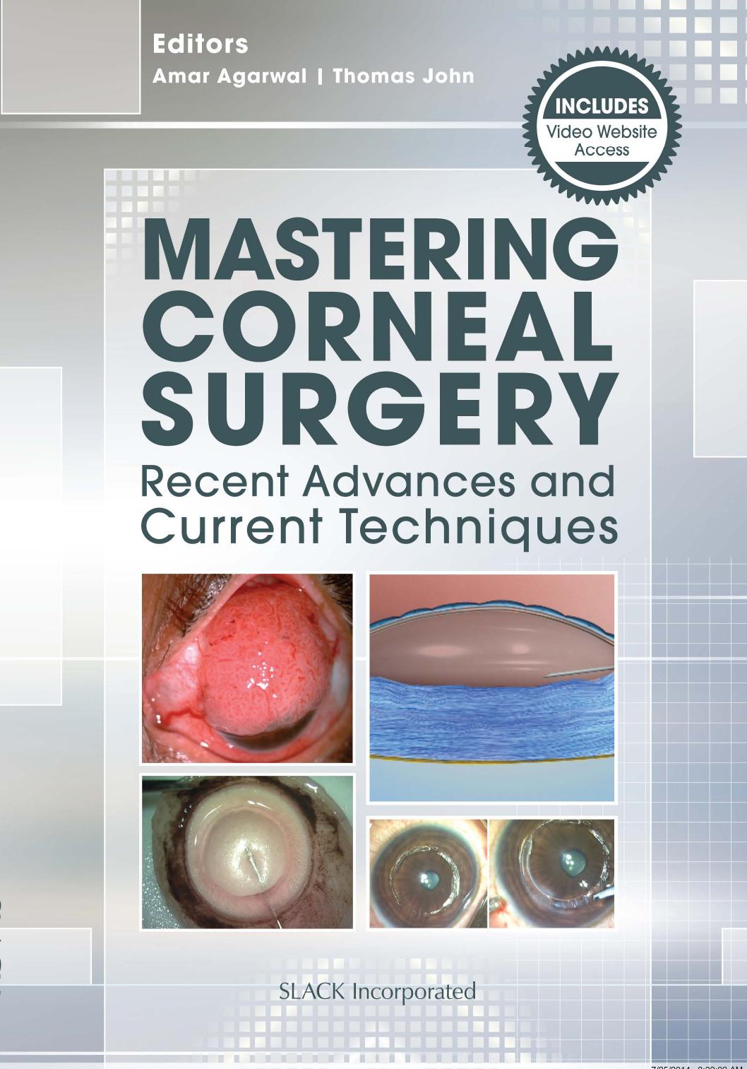 Mastering Corneal Surgery : Recent Advances and Current Techniques by Amar Agarwal; Thomas John