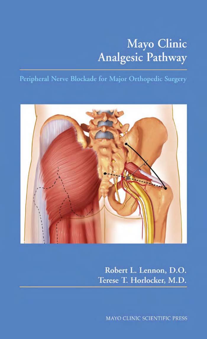 Mayo Clinic Analgesic Pathway Peripheral Nerve Blockade for Major Orthopedic Surgery by Test