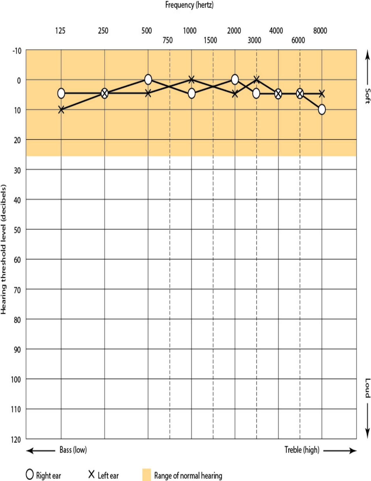 Mayo Clinic on Better Hearing and Balance by Mayo Clinic
