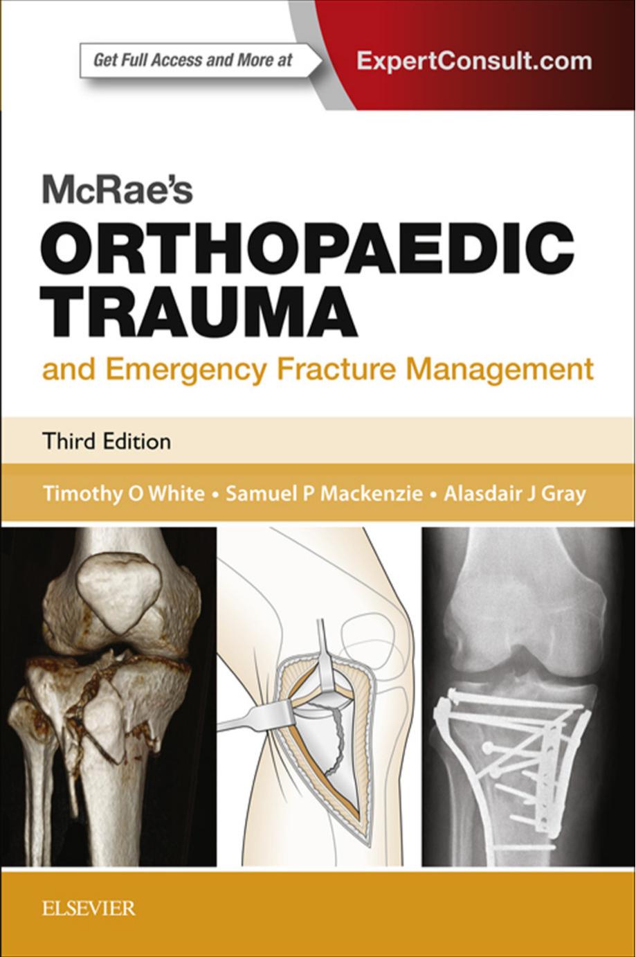 McRaeâs Orthopaedic Trauma and Emergency Fracture Management by Timothy O White Samuel P Mackenzie Alasdair J Gray