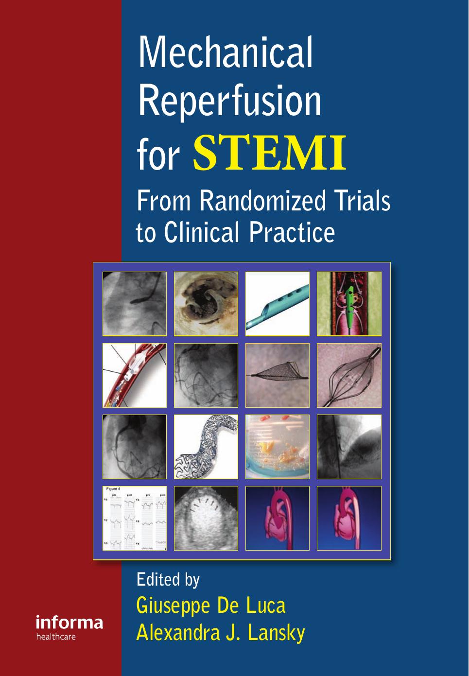 Mechanical Reperfusion for STEMI: From Randomized Trials to Clinical Practice by Giuseppe De Luca Alexandra Lansky