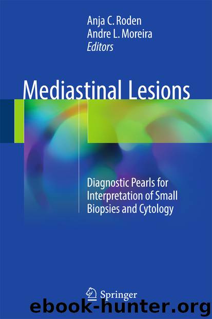 Mediastinal Lesions by Anja C. Roden & Andre L. Moreira