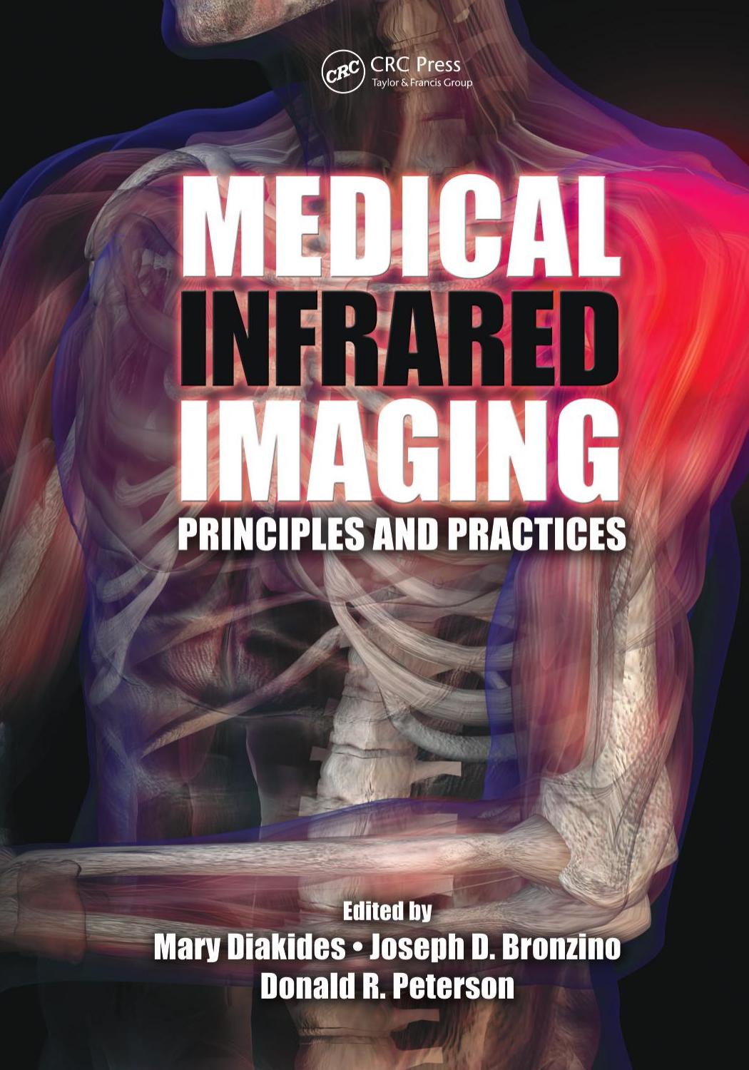 Medical Infrared Imaging by Bronzino Joseph D. Peterson Donald R. Diakides Mary