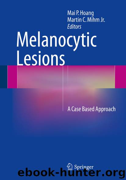 Melanocytic Lesions by Mai P. Hoang & Martin C. Mihm