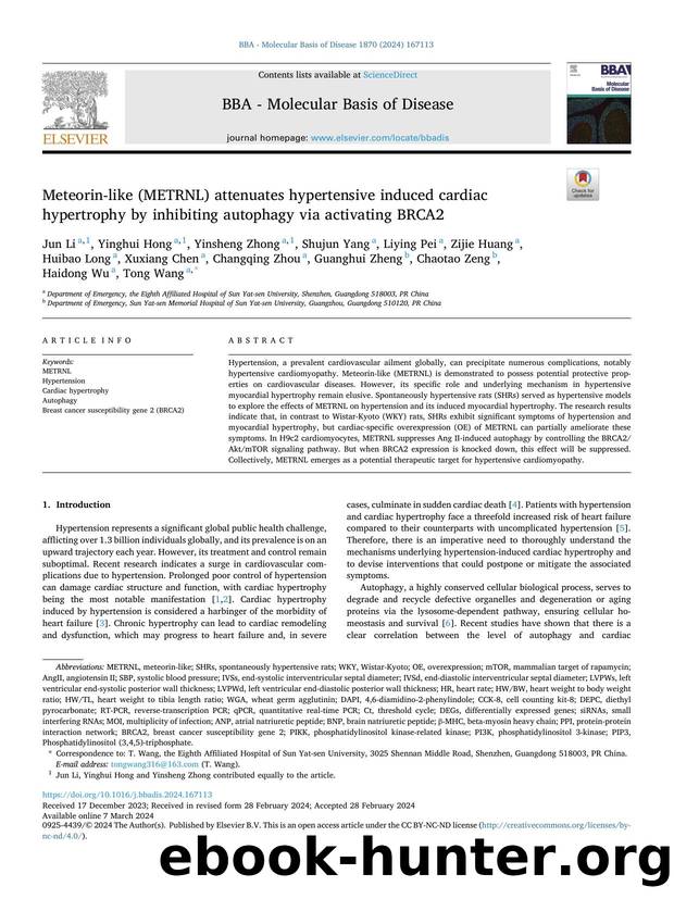 Meteorin-like (METRNL) attenuates hypertensive induced cardiac hypertrophy by inhibiting autophagy via activating BRCA2 by unknow
