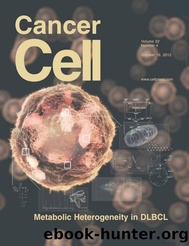 Methylome Alterations ââMarkââ New Therapeutic Opportunities in Glioblastoma by Eric H. Raabe and Charles G. Eberhart