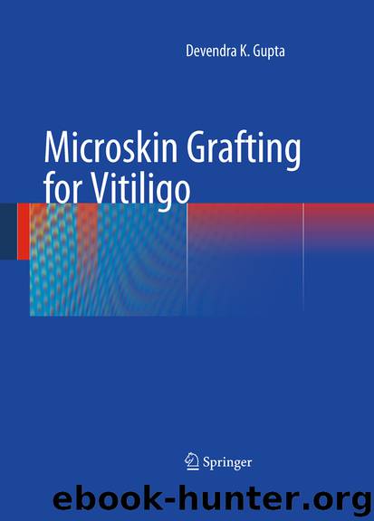 Microskin Grafting for Vitiligo by Devendra K. Gupta