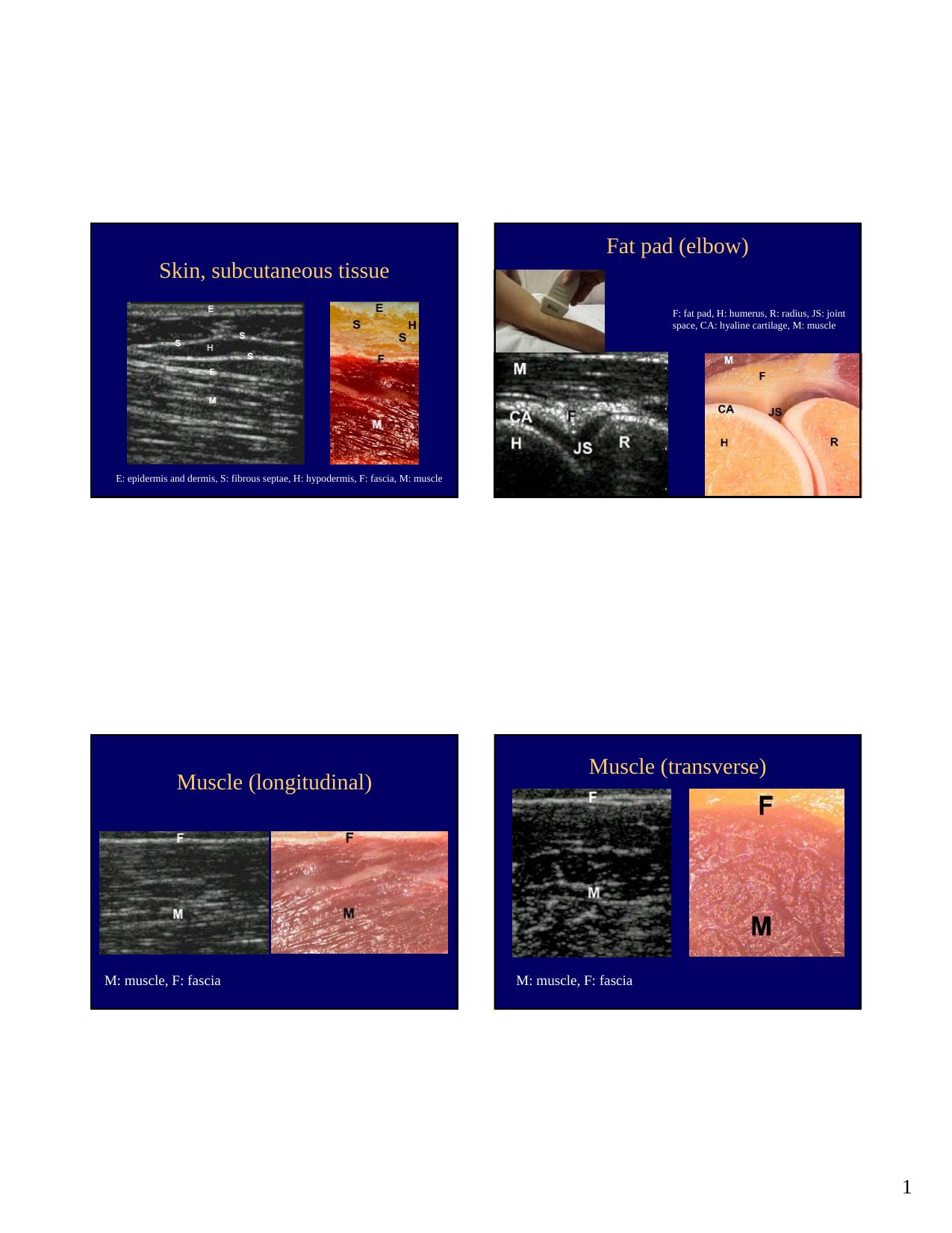 Microsoft PowerPoint - Basic sonor anatomy BKV by VallaBx1