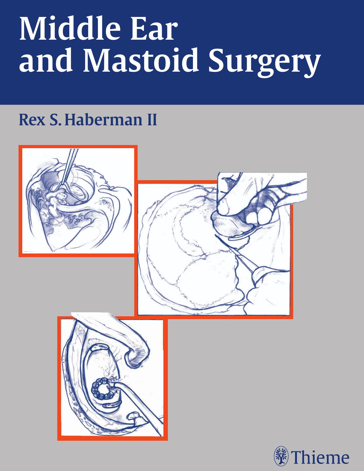 Middle Ear and Mastoid Surgery by Rex Haberman
