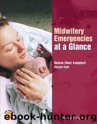 Midwifery Emergencies at a Glance by Campbell Denise Carr Susan M. & Susan M. Carr