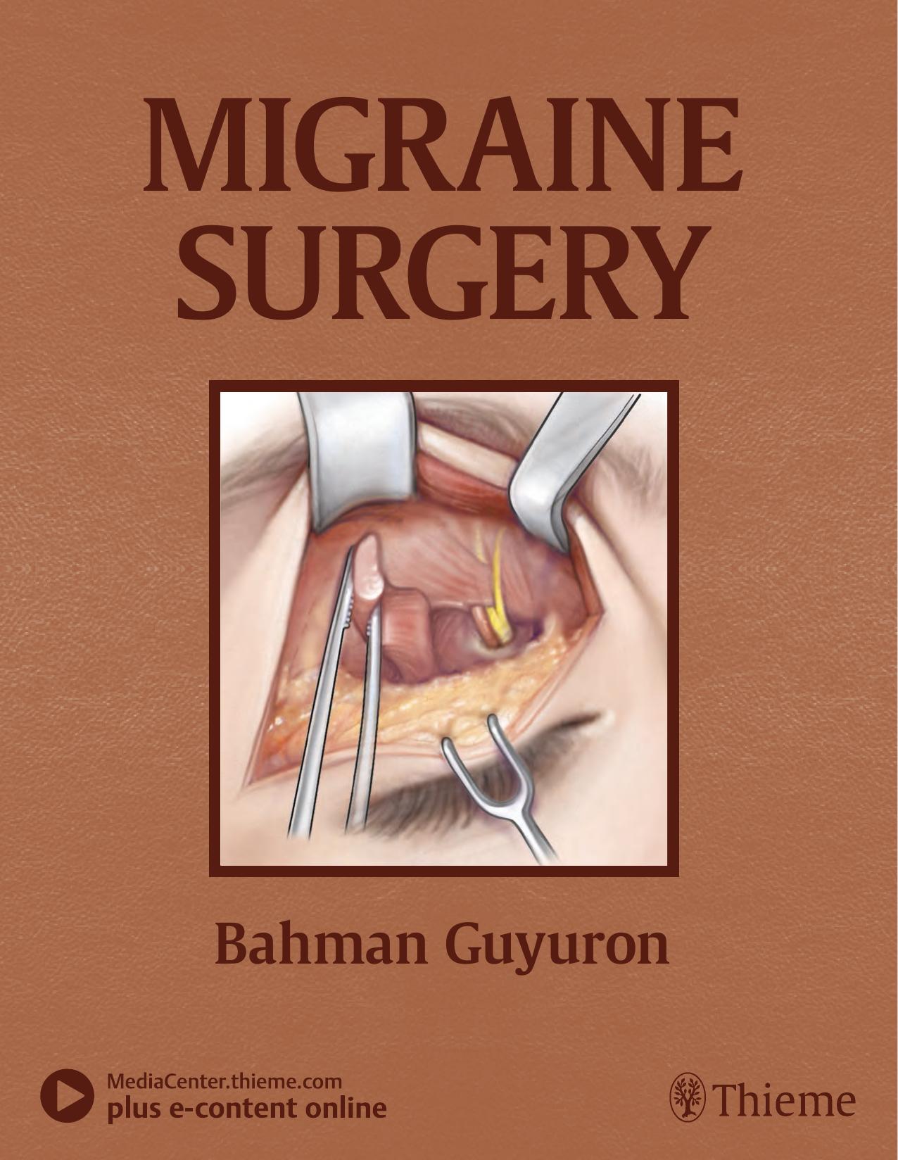 Migraine surgery by Guyuron Bahman