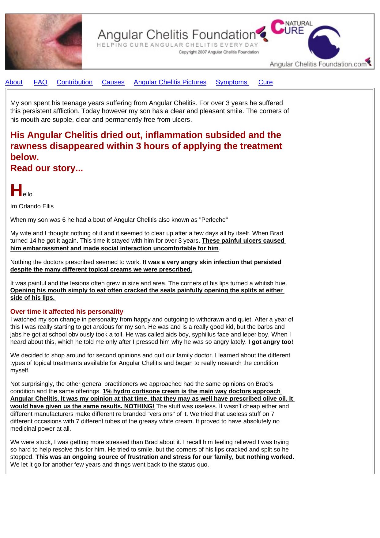 Millions Of Angular Chelitis Sufferers Can Be Cured In An Hour! by Best of Kuszter's Collection