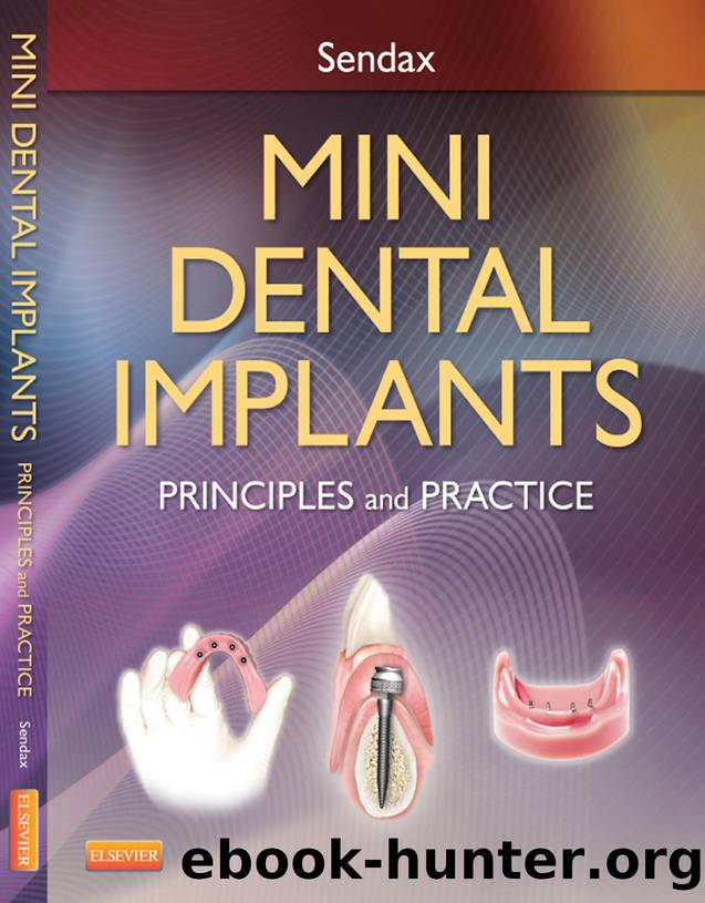 Mini Dental Implants: Principles and Practices by Principles & Practice