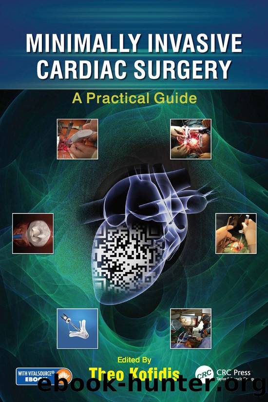 Minimally Invasive Cardiac Surgery by Kofidis Theo;
