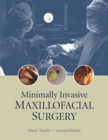 Minimally Invasive Maxillofacial Surgery by Maria J. Troulis Leonard B. Kaban