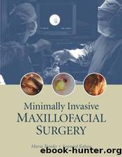 Minimally Invasive Maxillofacial Surgery by Unknown