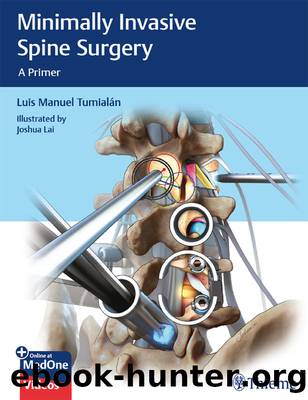 Minimally Invasive Spine Surgery: A Primer by Luis Manuel Tumialán Joshua Lai