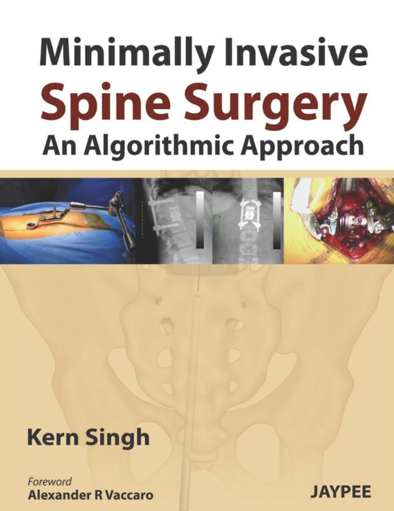 Minimally Invasive Spine Surgery: An Algorithmic Approach by Kern Singh
