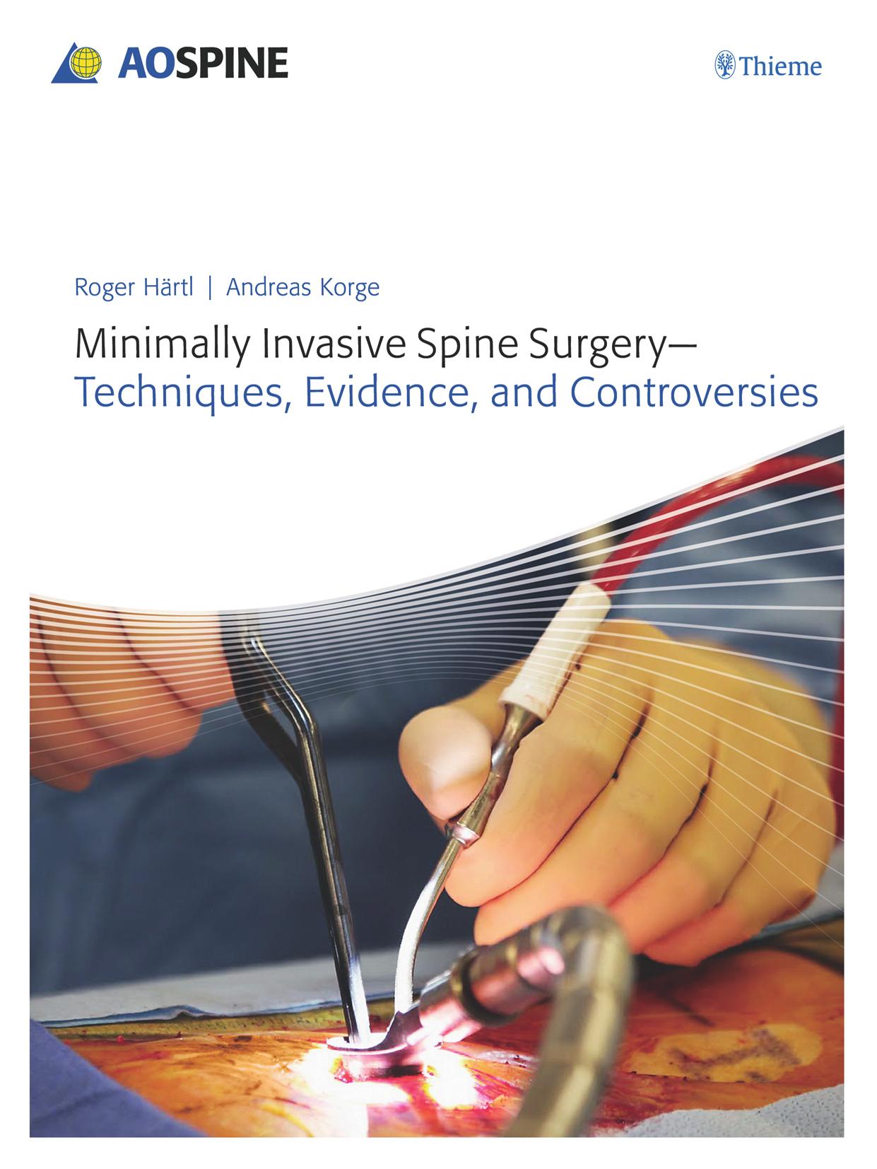 Minimally Invasive Spine Surgery: Techniques, Evidence, and Controversies by Roger Haertl Andreas Korge