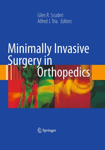 Minimally Invasive Surgery in Orthopedics by Aaron G. Rosenberg (auth.) Giles R. Scuderi Alfred J. Tria (eds.)