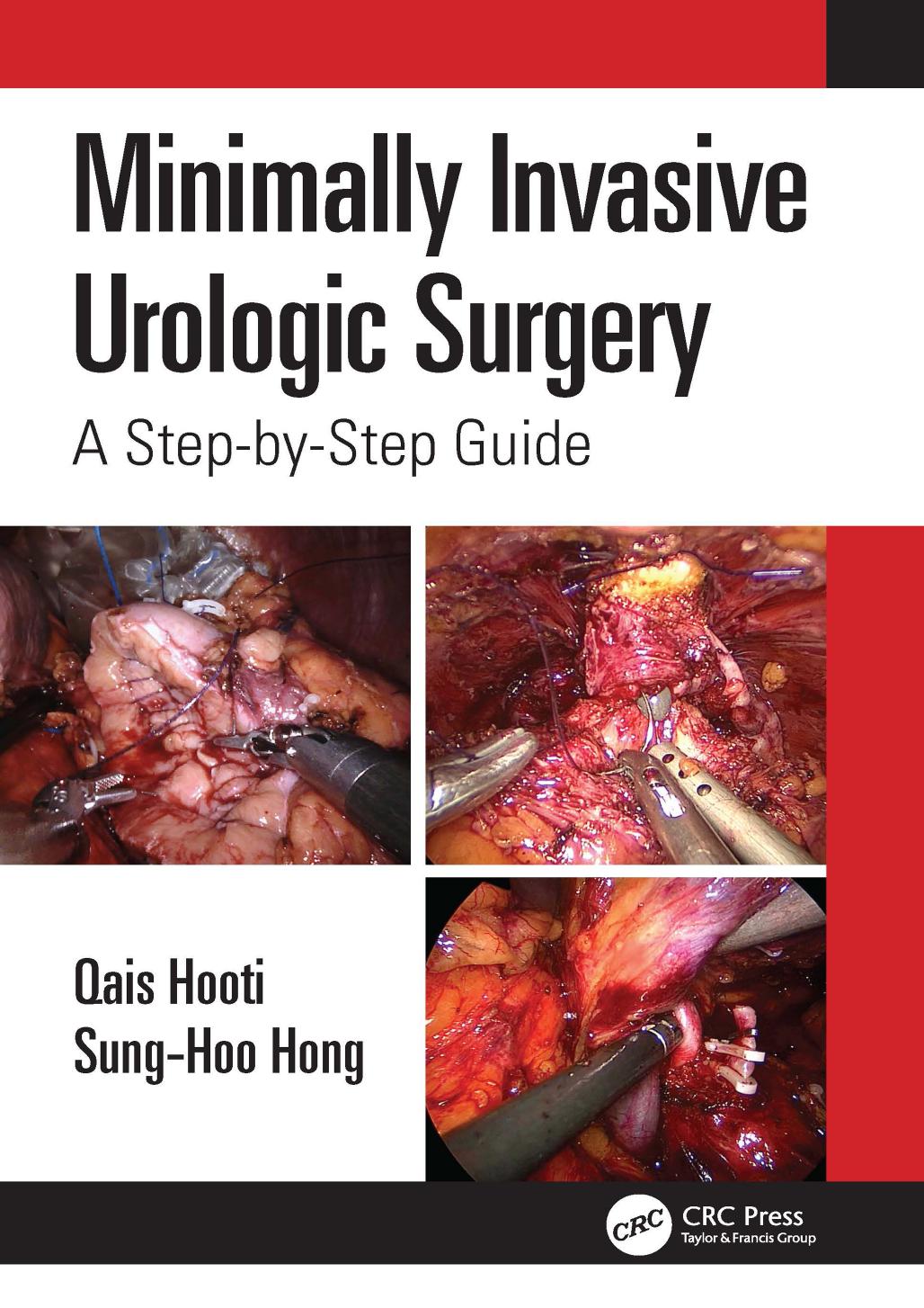 Minimally Invasive Urological Surgery; A Step-by-Step Guide by Qais Hooti & MD & SB-Urol & Sung-Hoo Hong & PhD