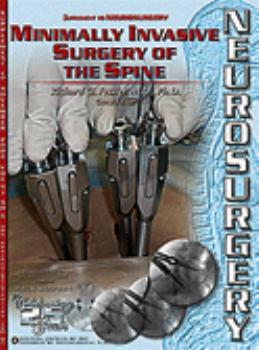 Minimally invasive surgery of the spine by Richard G. Fessler guest editor