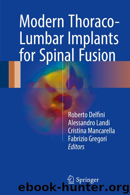 Modern Thoraco-Lumbar Implants for Spinal Fusion by Roberto Delfini Alessandro Landi Cristina Mancarella & Fabrizio Gregori