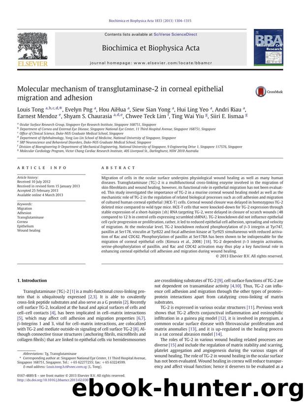Molecular mechanism of transglutaminase-2 in corneal epithelial migration and adhesion by unknow