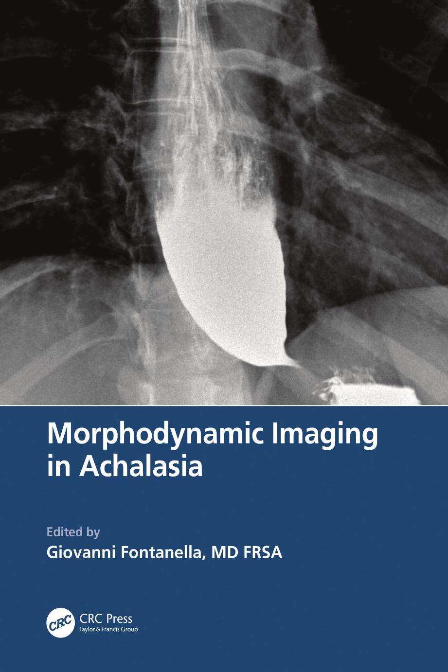 Morphodynamic Imaging in Achalasia by Giovanni Fontanella