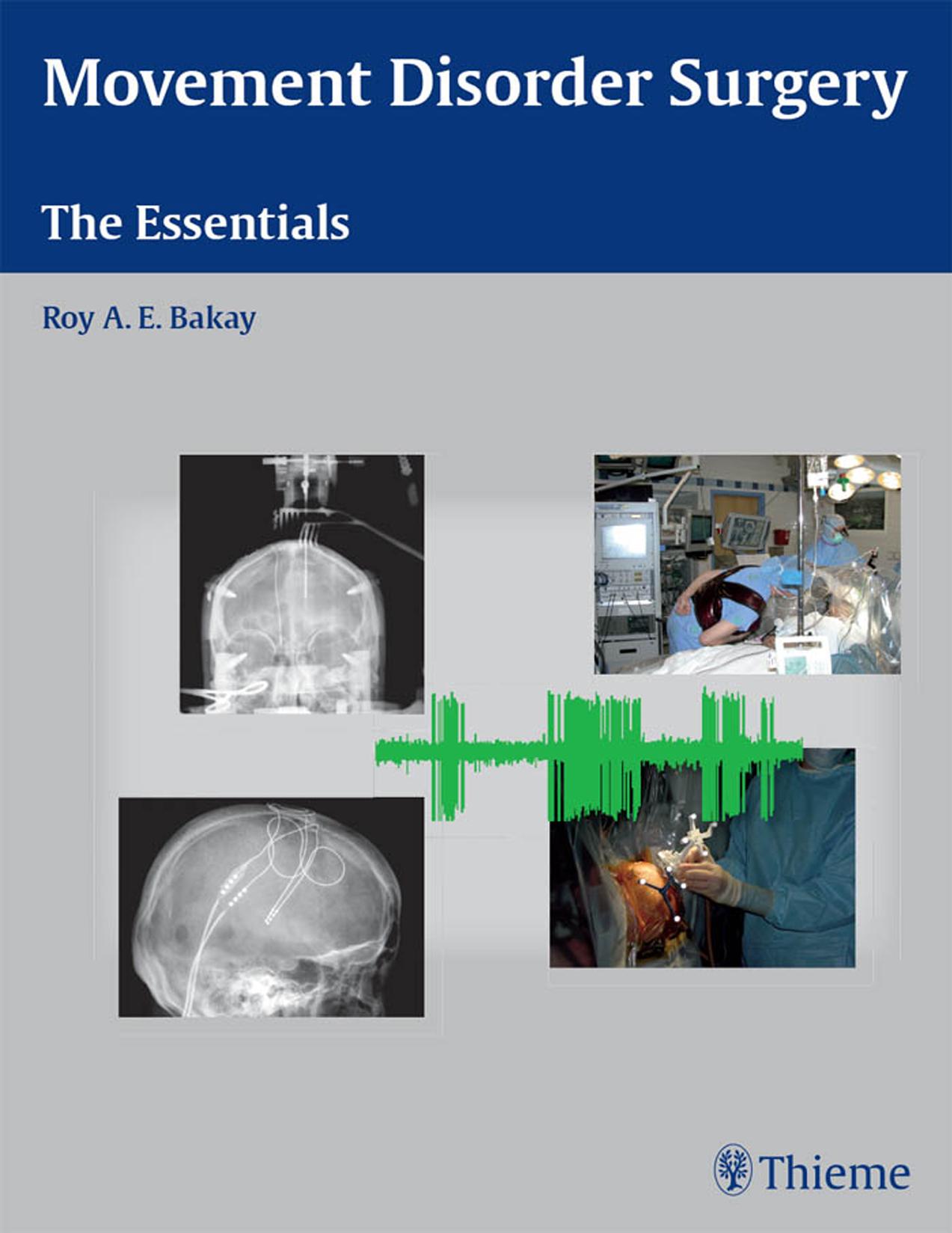 Movement disorder surgery: the essentials by Bakay Roy A. E