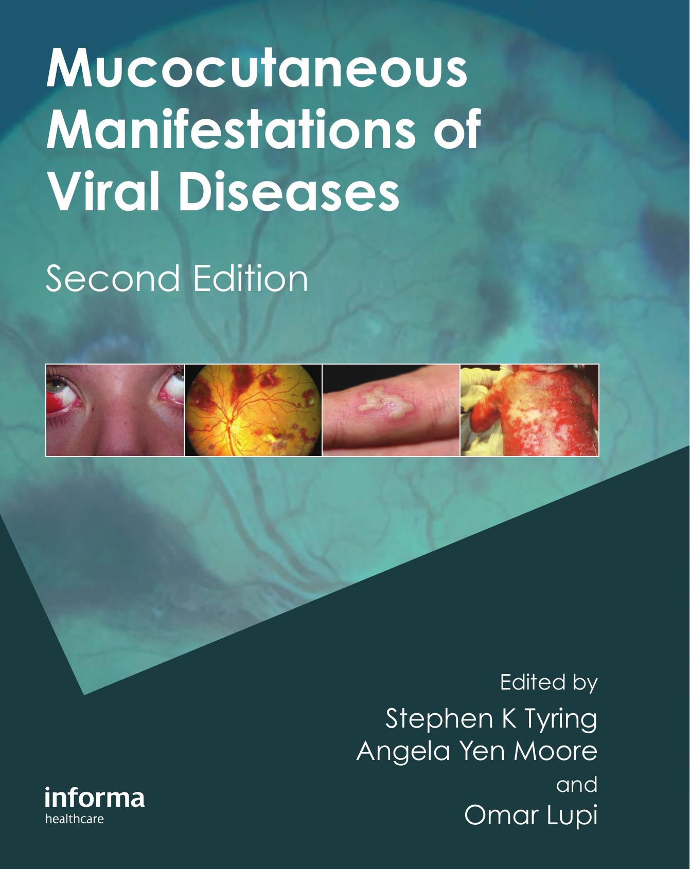 Mucocutaneous Manifestations of Viral Diseases: An Illustrated Guide to Diagnosis and Management, Second Edition by Stephen Tyring Angela Yen Moore Omar Lupi