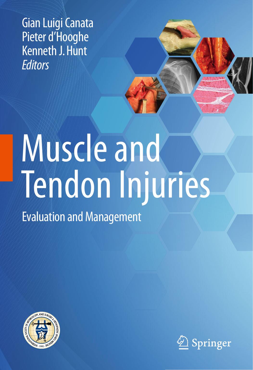 Muscle and Tendon Injuries: Evaluation and Management by Gian Luigi Canata Pieter d'Hooghe Kenneth J. Hunt (eds.)