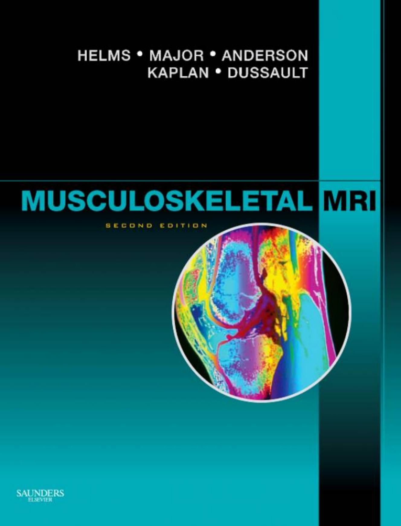 Musculoskeletal MRI, Second Edition by Clyde A. Helms MD Nancy M. Major MD Mark W. Anderson MD Phoebe Kaplan MD Robert Dussault MD