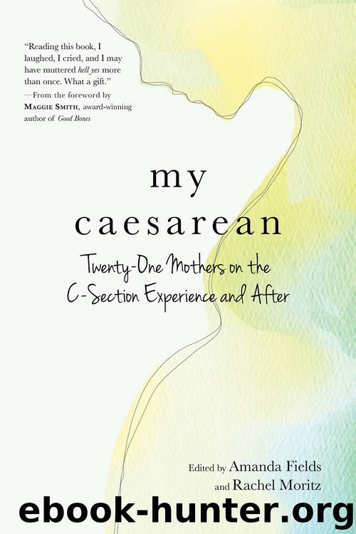 My Caesarean by Amanda Fields