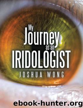 My Journey as an Iridologist by Joshua Wong