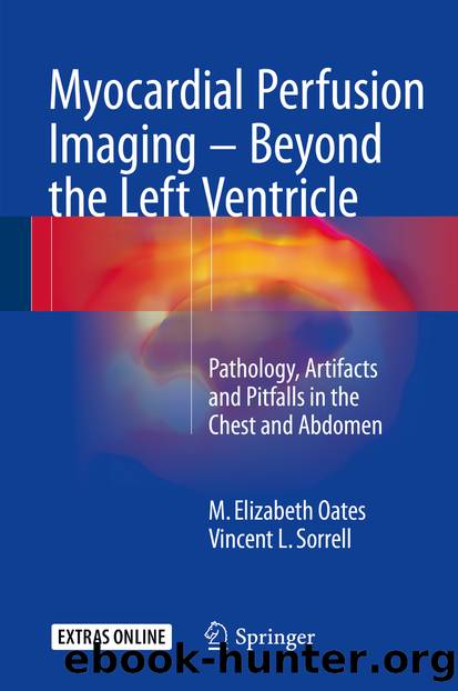 Myocardial Perfusion Imaging - Beyond the Left Ventricle by M. Elizabeth Oates & Vincent L. Sorrell
