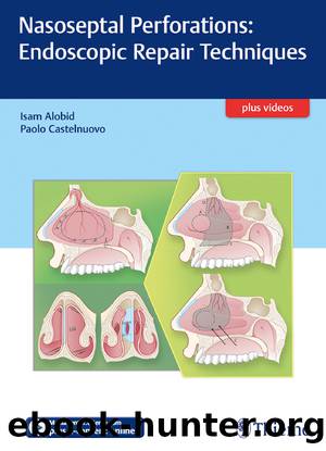 Nasoseptal Perforations: Endoscopic Repair Techniques by Alobid Isam;Castelnuovo Paolo;