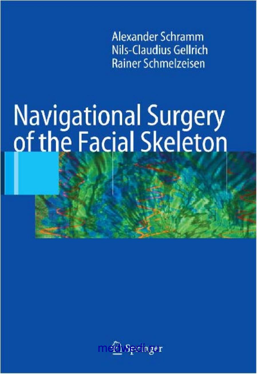Navigational Surgery of the Facial Skeleton by Schramm A. Gellrich N-C. Schmelzeisen R