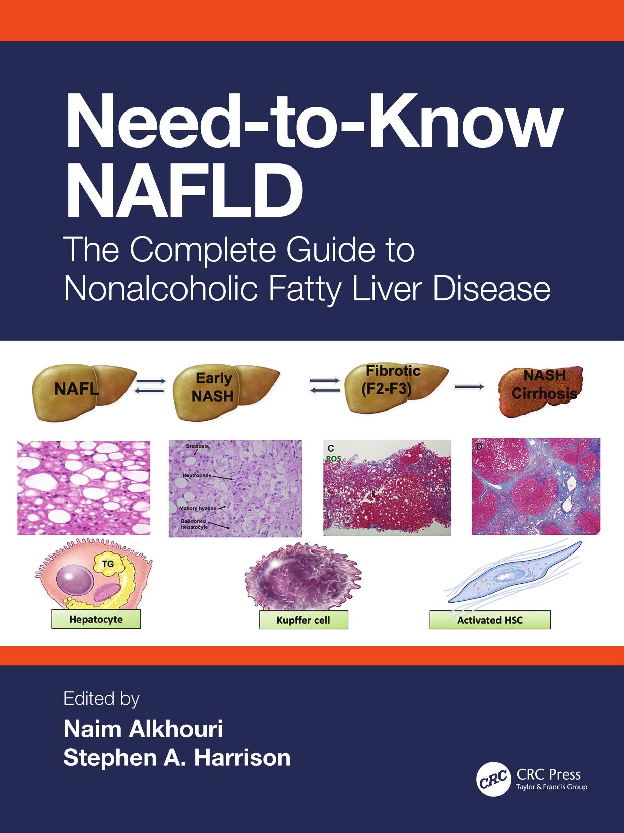 Need-to-Know NAFLD: The Complete Guide to Nonalcoholic Fatty Liver Disease (by Team-IRA) by Naim Alkhouri (editor) Stephen A. Harrison (editor)