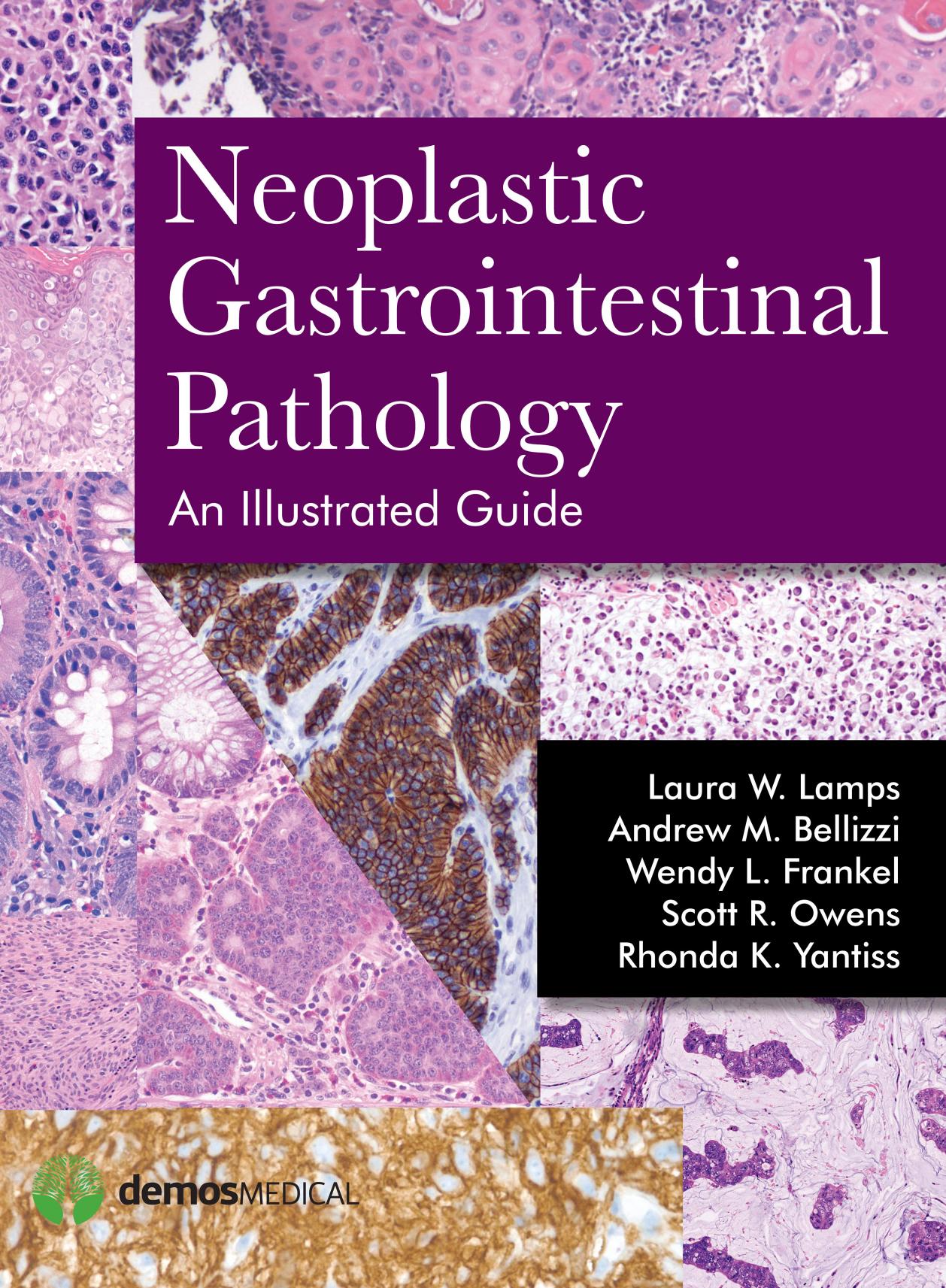 Neoplastic gastrointestinal pathology : an illustrated guide by Andrew M. Bellizzi; Laura Webb Lamps; Wendy L. Frankel; Scott R. Owens; Rhonda K. Yantiss